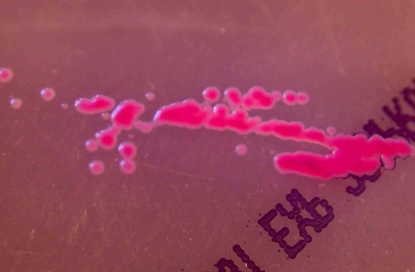 Salmonellenwachstum auf Nährboden