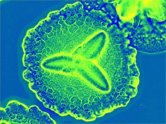 Actinobacillus actinomyc